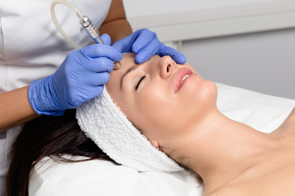 microdermabrasion